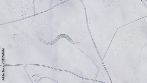 Wallpaper Mural Nematode under microscope bright field view Torontodigital.ca