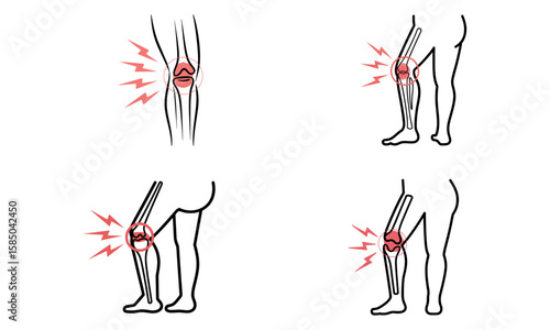 Knee pain icon set showing joint inflammation and red highlighted injury symptoms
