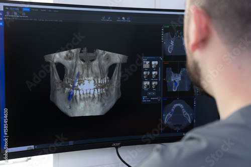 Detailed 3D Imaging of a Dental Structure on a Computer Screen with User Observing for Analysis in a Modern Dental Practice Environment