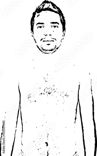 Man with chickenpox
