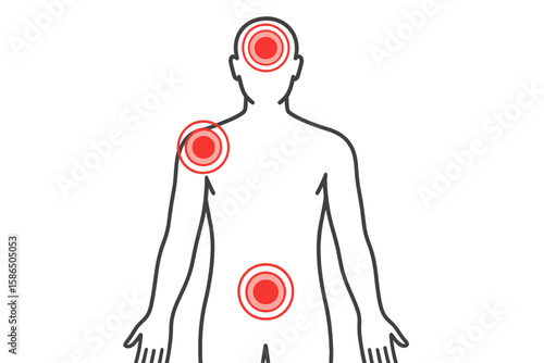 Human body pain map vector. Red circles indicate pain points, ache, or injury in the head, shoulder, and abdomen. Medical health symptom concept, anatomy infographic illustration.