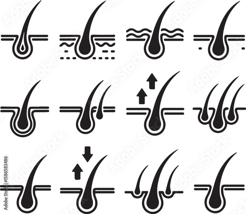 Hair Follicle Anatomy and Growth Cycle Stages Illustrated with Diagrams Representing Different Skin Conditions and Hair Development Process