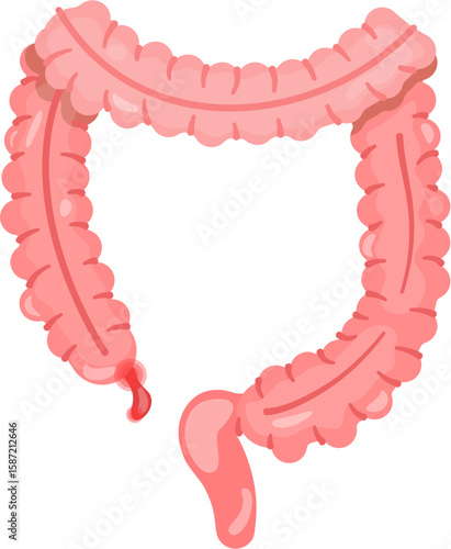 Appendicitis 