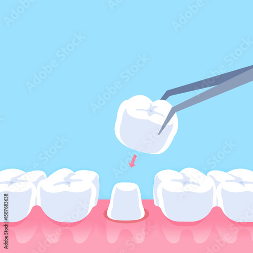 Dental crown - Text box banner (square) illustration vector design. Dental care concept.