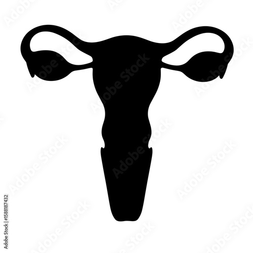 Silhouette of uterus with contraceptive types – Reproductive education visual aid