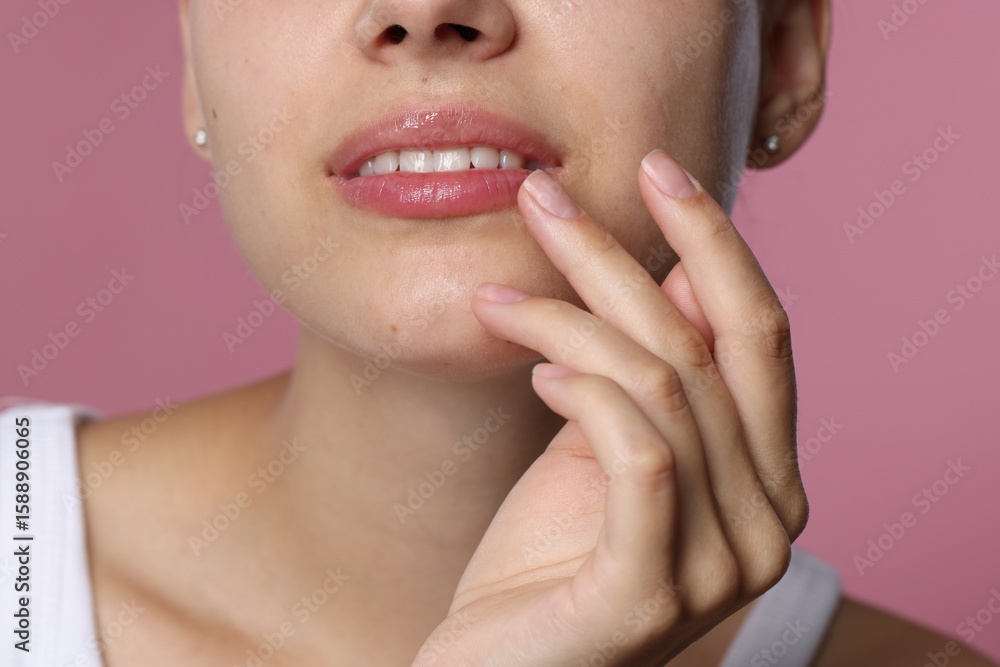 Fototapeta premium Young woman with lip balm on her lips against pink background, closeup