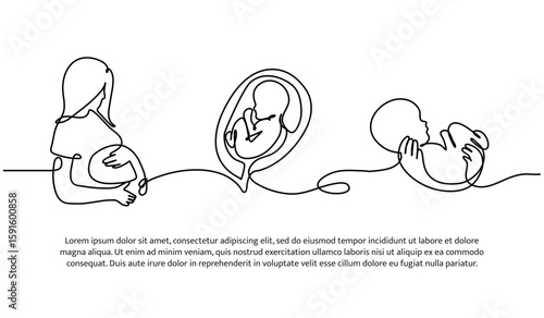 Continuous line design of a mother gives birth to a baby. Single line decorative element drawn on white.