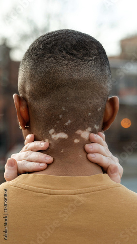 Hands gently holding neck with visible vitiligo spots, symbolizing care and affection