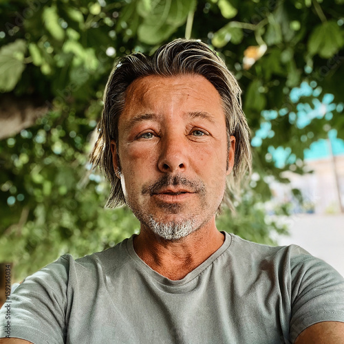 Tableau sur toile Swollen skin of face of tanned man with blond hair and grey stubble beard