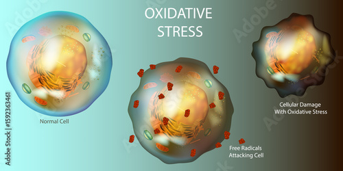 Oxidative Stress in Human Cell Damage Caused by Free Radicals. Biological Illustration of Normal and Oxidatively Stressed Cells. Free Radical Attack