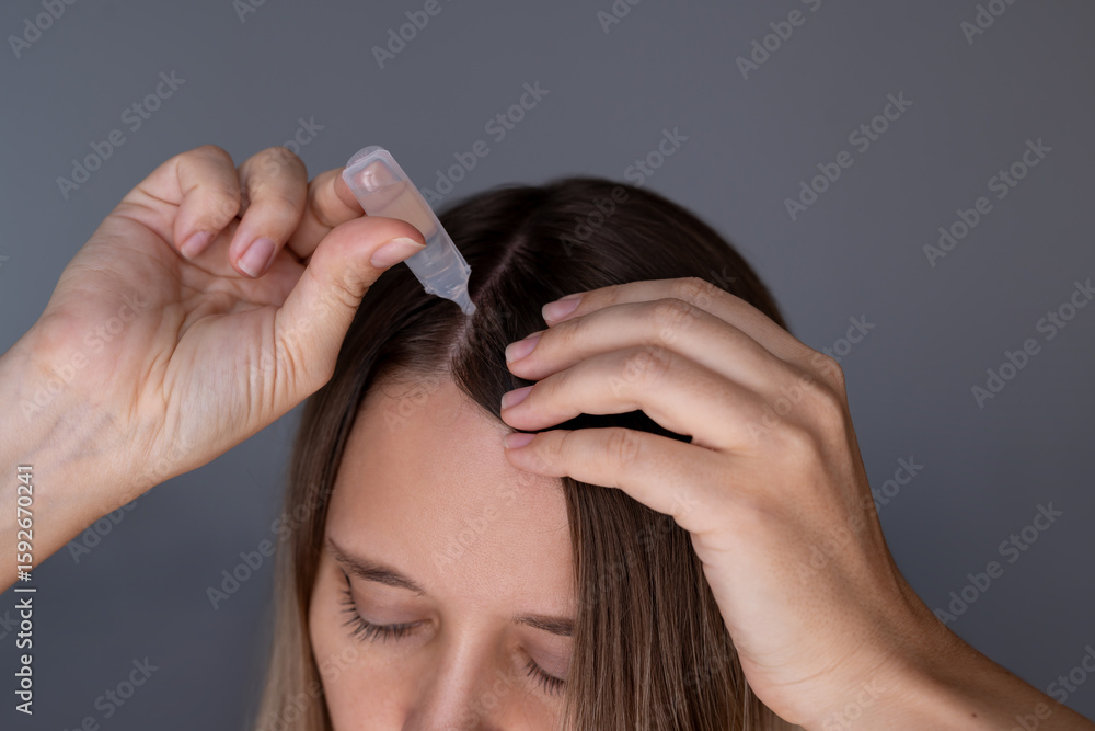 Fototapeta premium Close-up of a young woman applying nicotinic acid (vitamin B3) to the scalp using a small dropper bottle on a grey background. Hair growth treatment, haircare routine, self-care