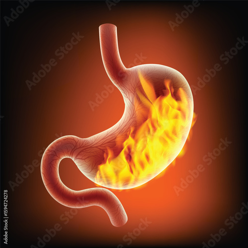 3D illustration of a human stomach with fire burning as a comparison to a person with severe gastritis. Used in medicine, science, education, advertising and industry.