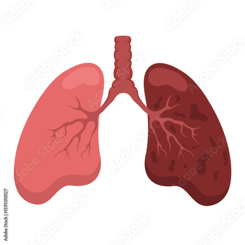 vector illustration of lungs damaged by smoking