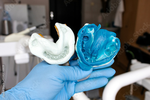 The doctor holds in his hand impressions of teeth for ceramic, zirconium crowns.