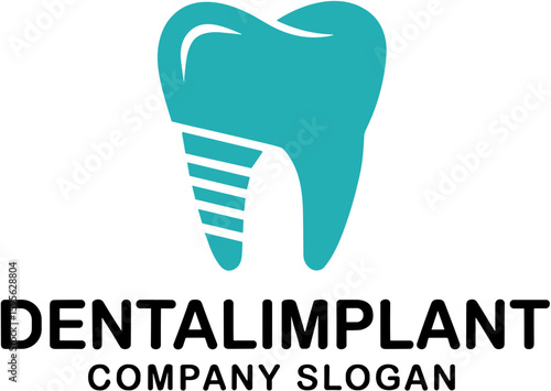 Dental Implant Logo Design