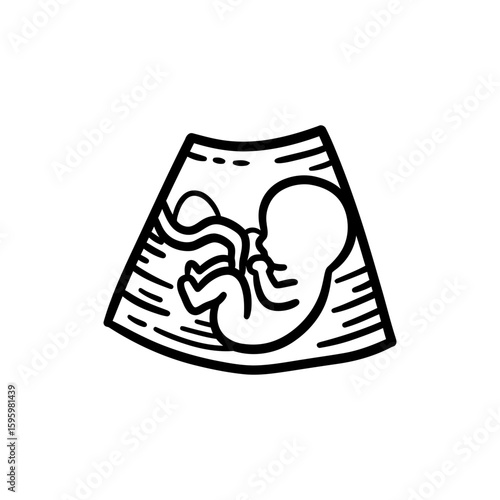 Ultrasound Fetus View for Pregnancy and Fetal Health Monitoring