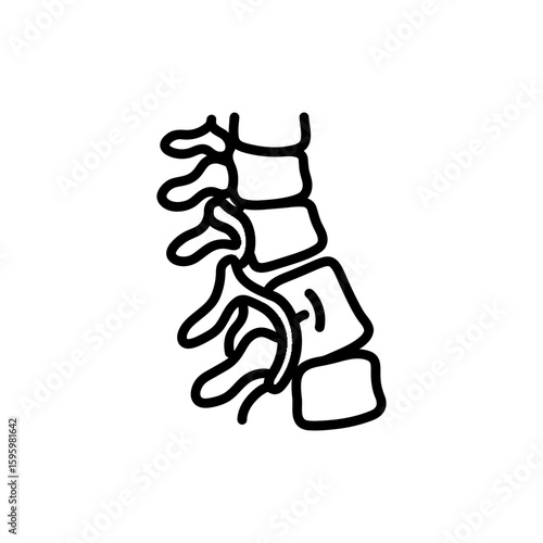 Spinal Disc Bulge with Nerves for Back Pain Treatment