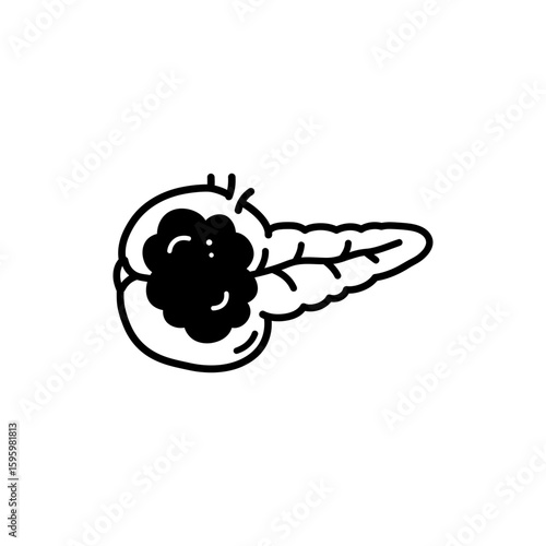 Pancreas Tumor Node for Cancerous Growth Representation