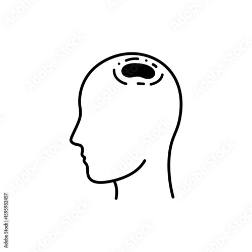 Alopecia Bald Spot Icon Representing Hair Loss and Thinning