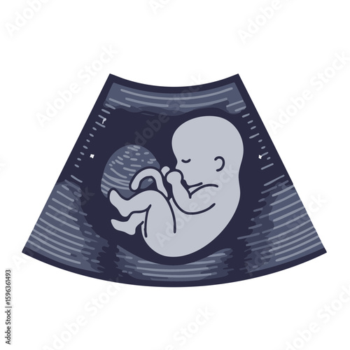 Vector illustration of baby scan ultrasound on white background, pregnancy symbol