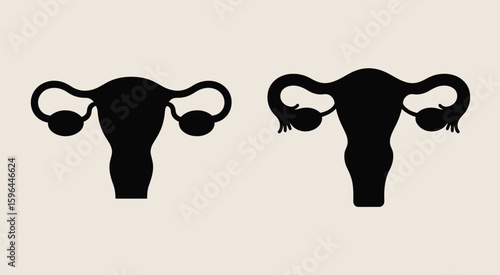 Silhouettes of female reproductive systems side by side