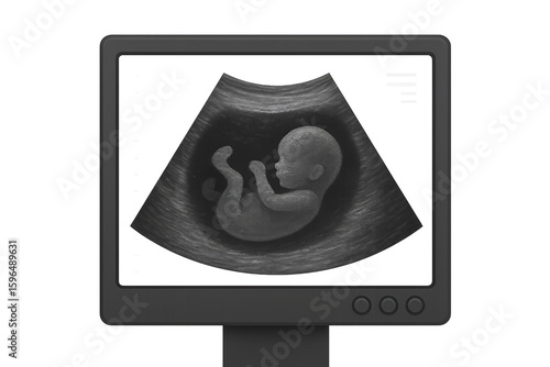 Ultrasound screen with baby shape, maternity care concept