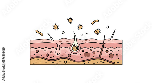 Detailed diagram of skin layers with acne and bacteria in linear style