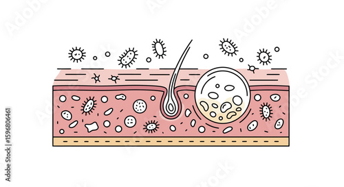 Skin anatomy with bacteria and acne in linear style