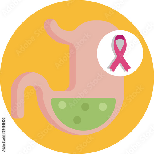 Illustration of a stomach with a cancer symbol, indicating gastric or stomach cancer.