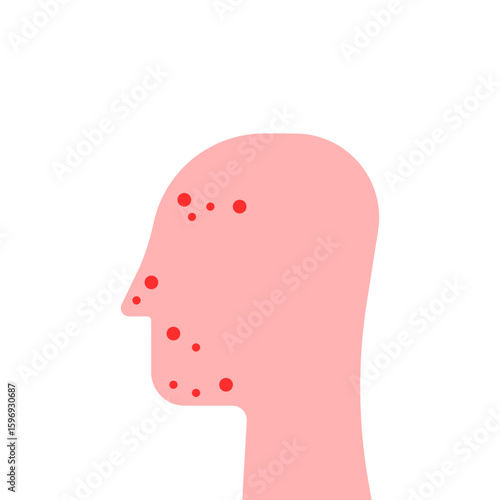red head with acne like problematic skin icon