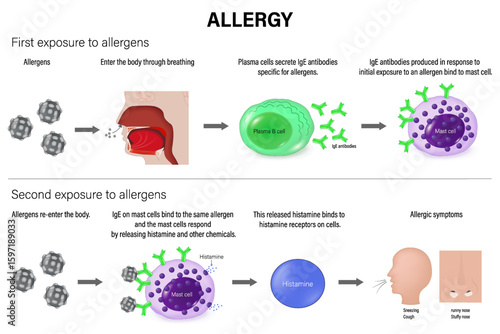 Allergy. Allergic response. Allergic reaction. Mechanism of allergy. Plasma B cell, antibodies and Mast cell. Human immune system. 