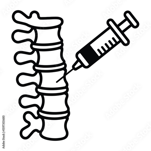 Spinal injection procedure illustration
