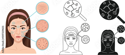 Understanding skin conditions a visual guide to wrinkles dryness and pores for skincare education editable