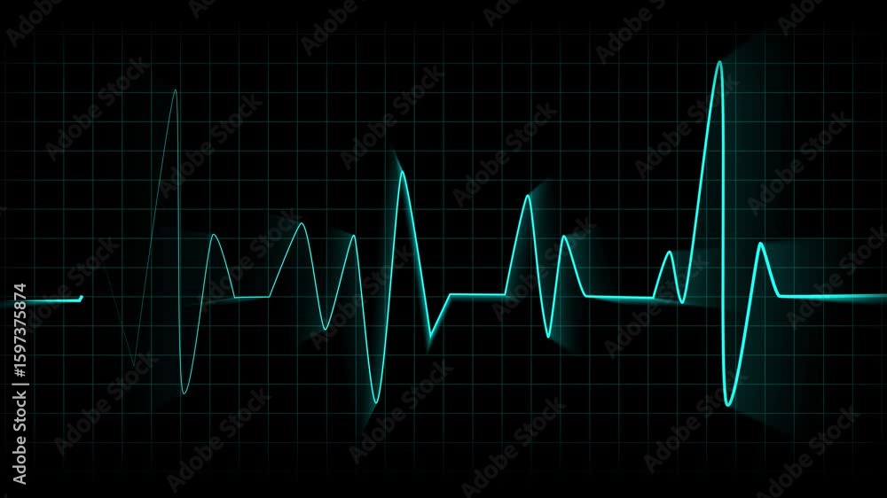 Neon glowing EKG pulse animation. Digital health care cardiac monitor screen looping motion graphics. Heartbeat EKG pulse animation. Medical technology science teal neon glowing line rhythm. Neon glowing EKG pulse animation. Digital health care cardiac monitor screen looping motion graphics. Heartbeat EKG pulse animation. Medical technology science teal neon glowing line rhythm.