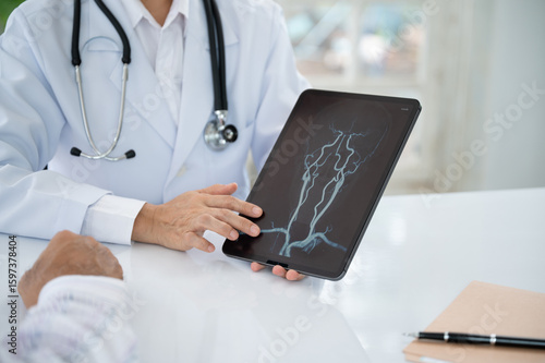 Neurosurgeon Doctor Surgery diagnose cerebral blood vessel x-ray image and diagnose stroke brain, nervous system diseases at neurology and Neurological Center.