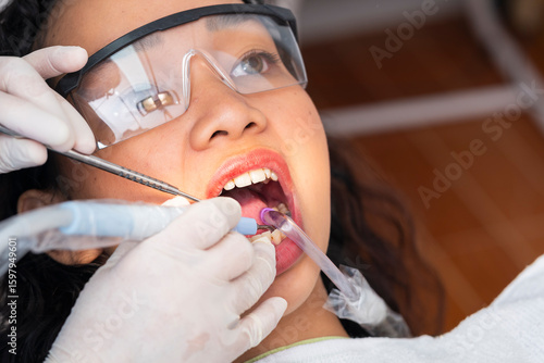 Photography Dental professional performs ultrasonic scaling and suction on a young woman during a routine oral prophylaxis procedure in clinic