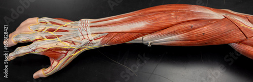 Superficial Forearm Dissection Focused On Wrist Extensor Muscles