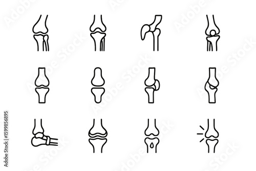 Diagram of human joint structures: knee, hip, elbow, and shoulder anatomy