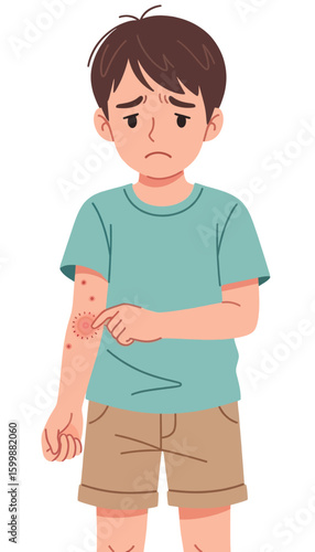 Unhappy Kid with Red Swollen Bug Bites on His Skin