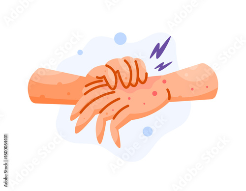 Illustration of a hand with a red rash or dermatitis, red spots, scratching due to itching. Health problems and skin diseases. Irritation and allergies. Hand gestures. Flat design style