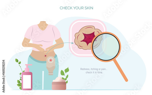 Patient checking stoma for redness, itching or pain using magnifying glass