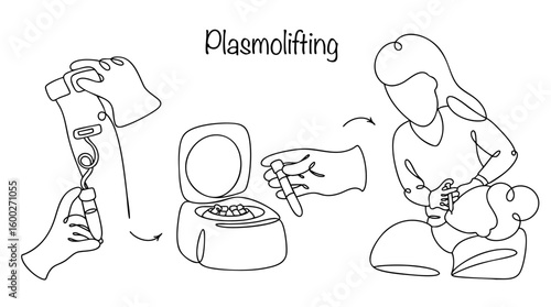 Plasmolifting