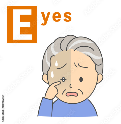脳卒中のBEFASTチェック「Eyes」シニア男性のイラスト