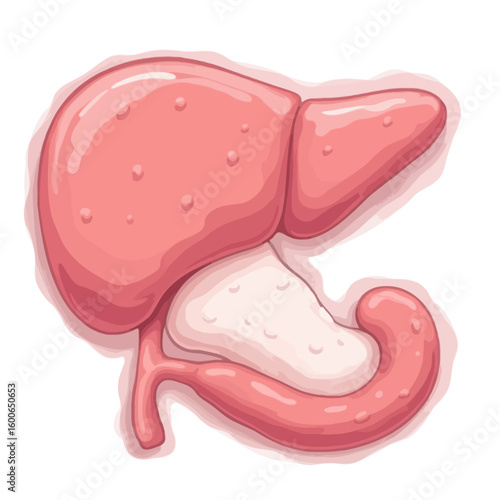Anatomical illustration of a human liver with symptoms of cirrhosis or fatty liver disease, shown alongside the pancreas and duodenum.