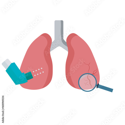 Asthma vector illustration showing wheezing, coughing, chest tightness, and shortness of breath; includes related conditions like bronchitis and COPD. Modern, medical design. lungs , magnifier, inhale