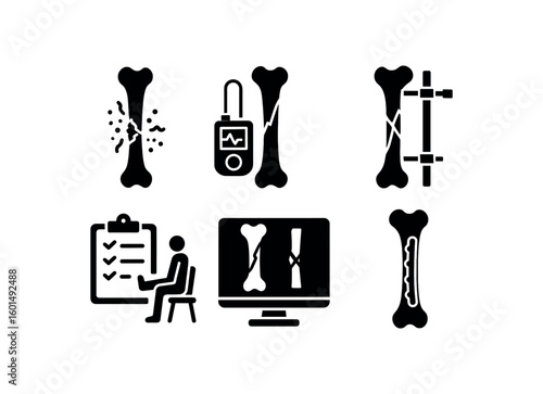 solid icon isolated femoral fracture periosteal callus formation femoral fracture compartment pressure monitor femoral fracture malalignment correction guide femoral fracture rehabilitation