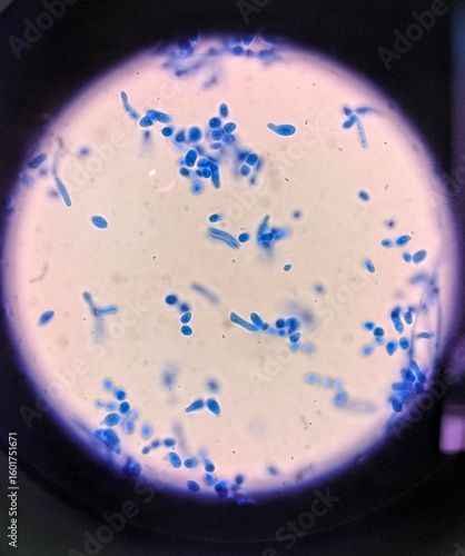 Canvas-taulu Fungal Spores Under a Microscope