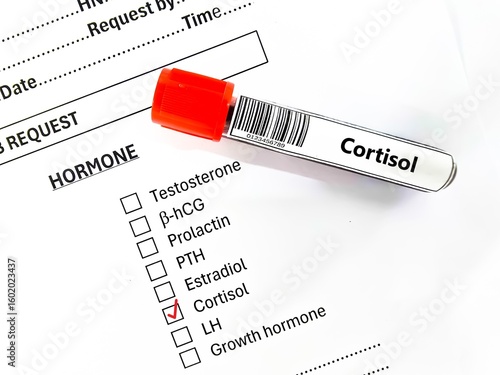 Blood sample tube and paper order request for cortisol test analysis.