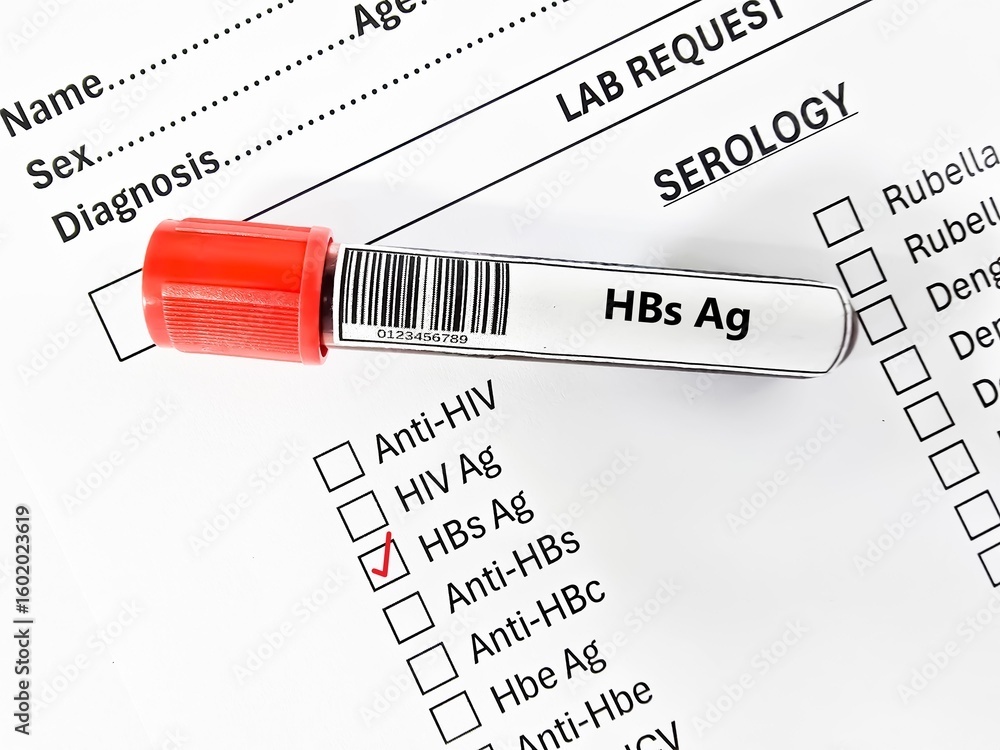 Obraz premium Blood sample tube and paper order request for HBs Ag test analysis.