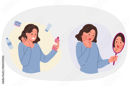 Teenage girl with pimples on face holds mirror and cream to get rid of traces of hormonal explosion. Puberty in young woman caused appearance of rashes or pimples and freckles on skin
